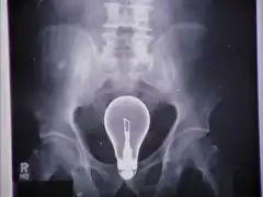 Клиника 4 сезон 2 серия